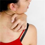 What should I do if my hands are itchy after using laundry detergent?